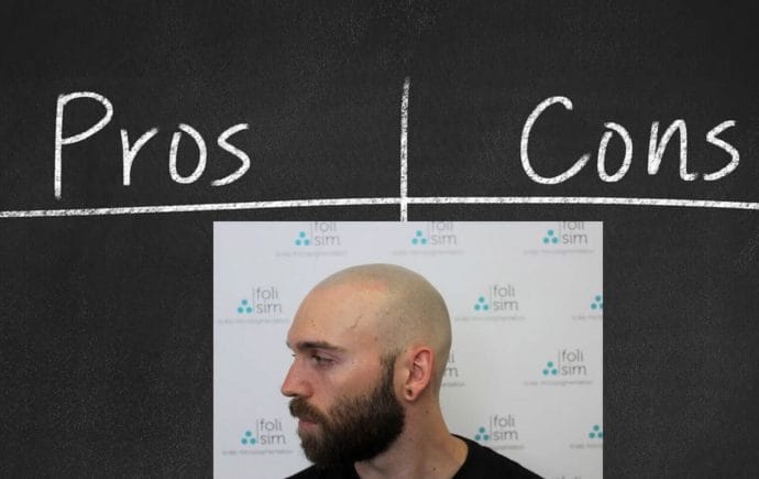 Pros and Cons of Scalp Micropigmentation