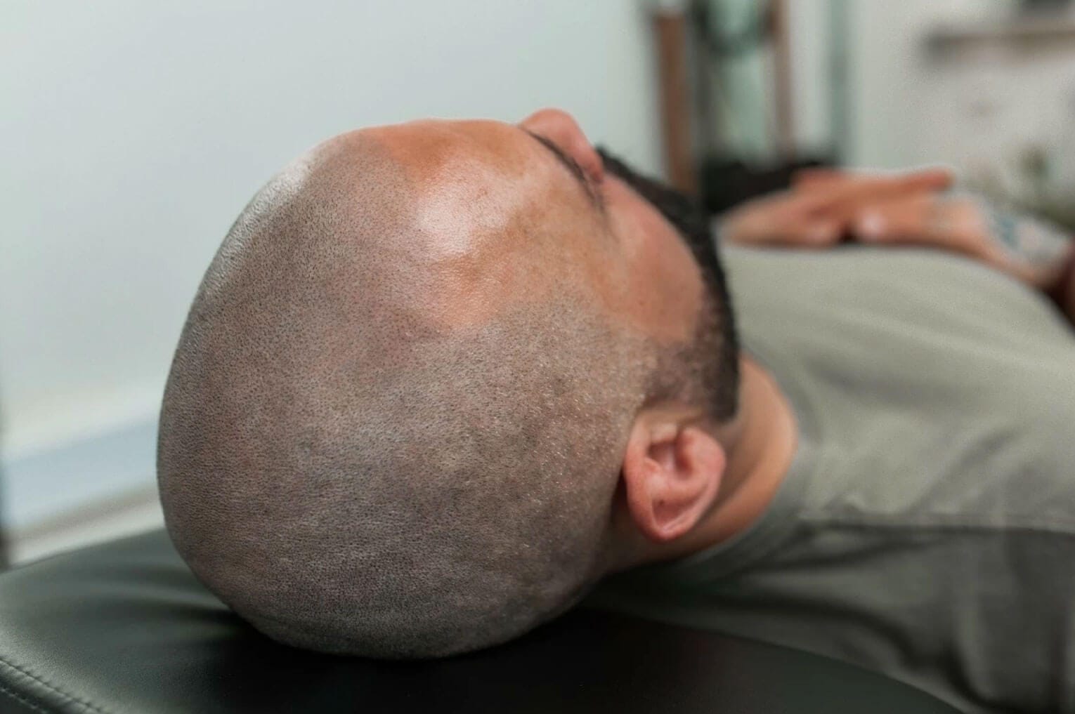 What Does Scalp Micropigmentation Look Like