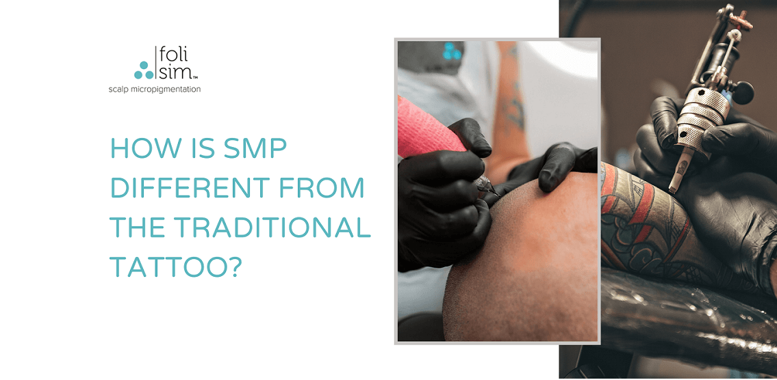 scalp micropigmentation vs tattoo