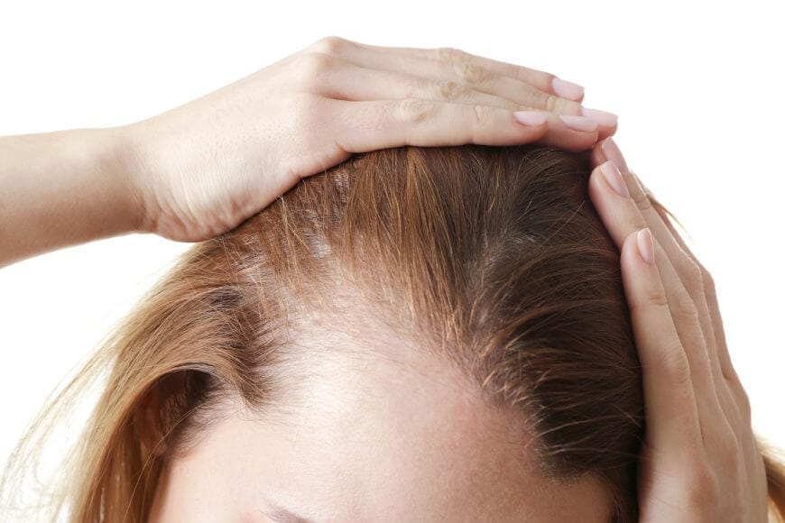 Can hair loss be a medical condition