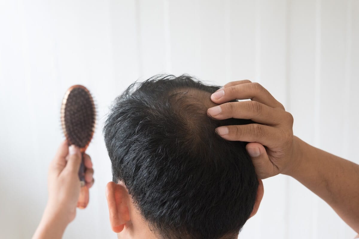 Factors contributing to increased hair shedding